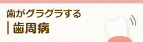 歯がグラグラする 歯周病
